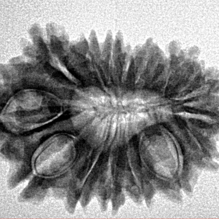 16 Mukhi Rudraksha 27.8mm 3.66gm - Inverse xray