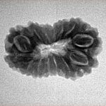 14 Mukhi Rudraksha 24mm 2.31gm - Inverse xray