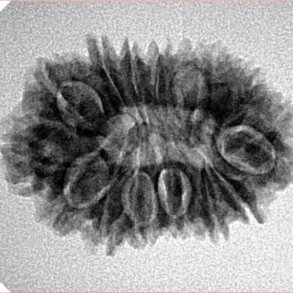 16 Mukhi Rudraksha 26.6mm 3.38gm - Inverse xray