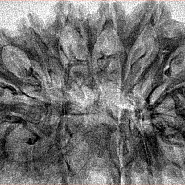 16 Mukhi Rudraksha 40.2mm 3.8gm - Inverse xray