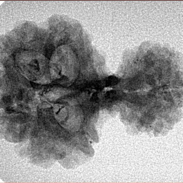 8 MK Garbhgauri & Ganesh 29.1mm 2.78gm - Inverse xray