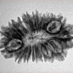 17 Mukhi Rudraksha 27.3mm 3.15gm - Origin: Nepal - Inverse xray