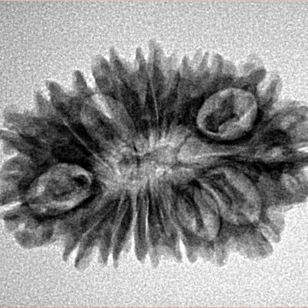 17 Mukhi Rudraksha 27.3mm 3.15gm - Origin: Nepal - Inverse xray