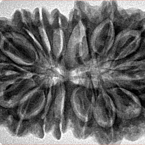 16 Mukhi Rudraksha 36.2mm 7.68gm - Inverse xray