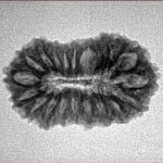 20 Mukhi Rudraksha 24.6mm 2.5gm - Inverse xray