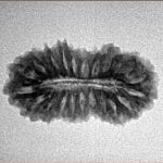 22 Mukhi Rudraksha 24.5mm 2.22gm - Inverse xray
