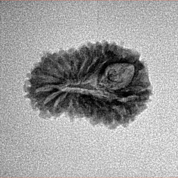 19 Mukhi Rudraksha 18.9mm 1.26gm - Inverse xray