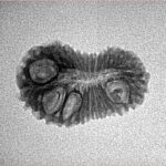 22 Mukhi Rudraksha 20.7mm 1.29gm - Inverse xray