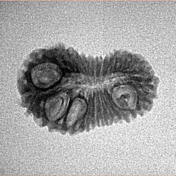 22 Mukhi Rudraksha 20.7mm 1.29gm - Inverse xray