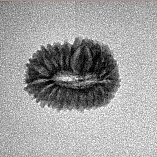 20 Mukhi Rudraksha 15.9mm 1gm - Inverse xray