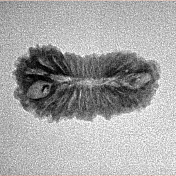 25 Mukhi Rudraksha 21.5mm 1.23gm - Inverse xray