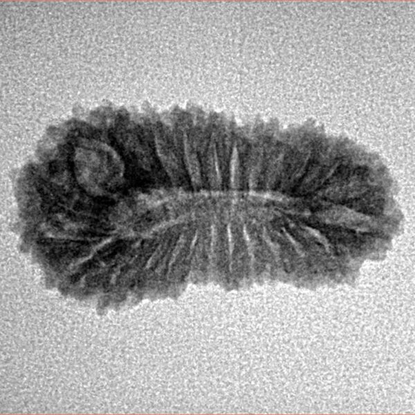 25 Mukhi Rudraksha 24.1mm 1.9gm - Inverse xray