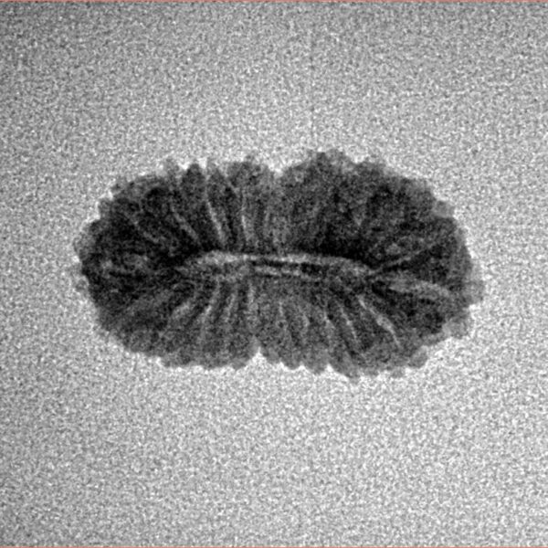 21 Mukhi Rudraksha 19.3mm 1gm - Inverse xray