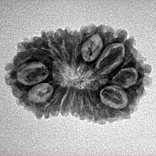 16 Mukhi Rudraksha 23.9mm 2.45gm - Inverse xray