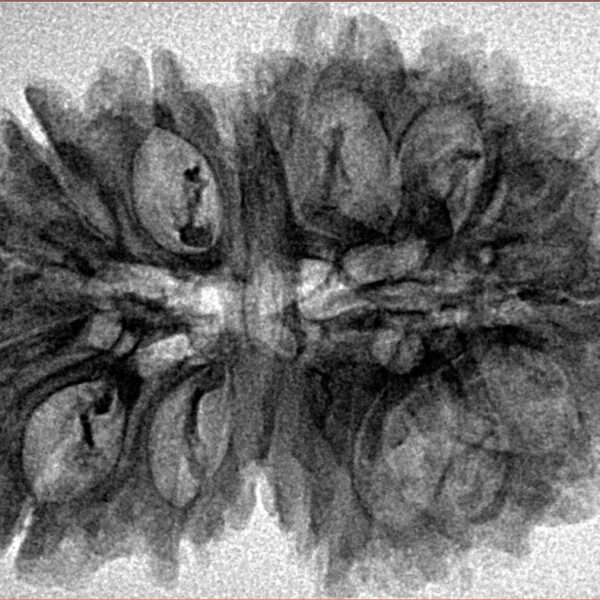 16 Mukhi Rudraksha 33.6mm 5.53gm - Inverse xray