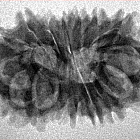 16 Mukhi Rudraksha 24.7mm 2.66gm - Inverse xray