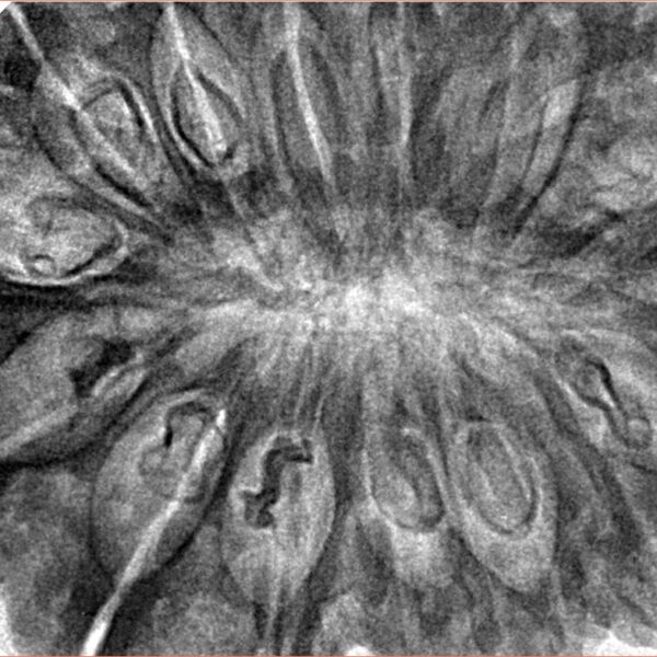 17 Mukhi Rudraksha 40.5mm 10.32gm - Inverse xray