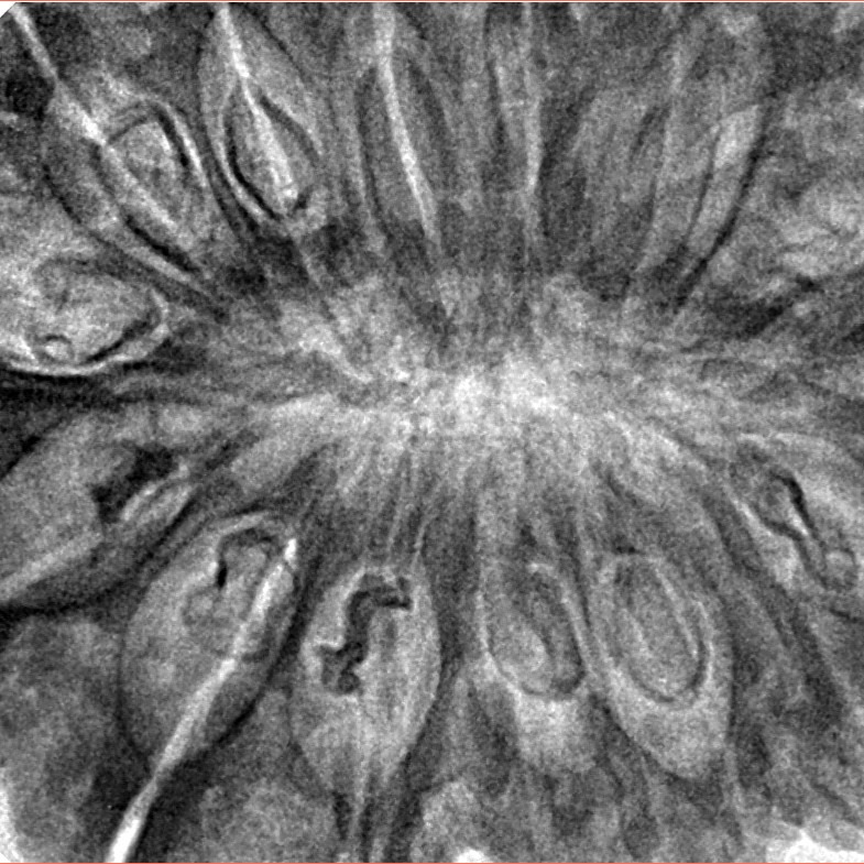 17 Mukhi Rudraksha 40.5mm 10.32gm - Inverse xray