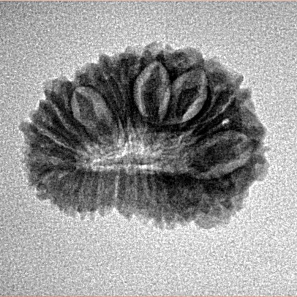 20 Mukhi Rudraksha 21.1mm 2gm - Inverse xray