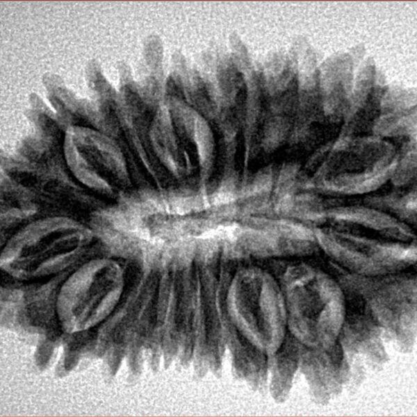 18 Mukhi Rudraksha 31.5mm 4.86gm - Inverse xray