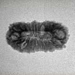 22 Mukhi Rudraksha 21.9mm 1.42gm - Inverse xray