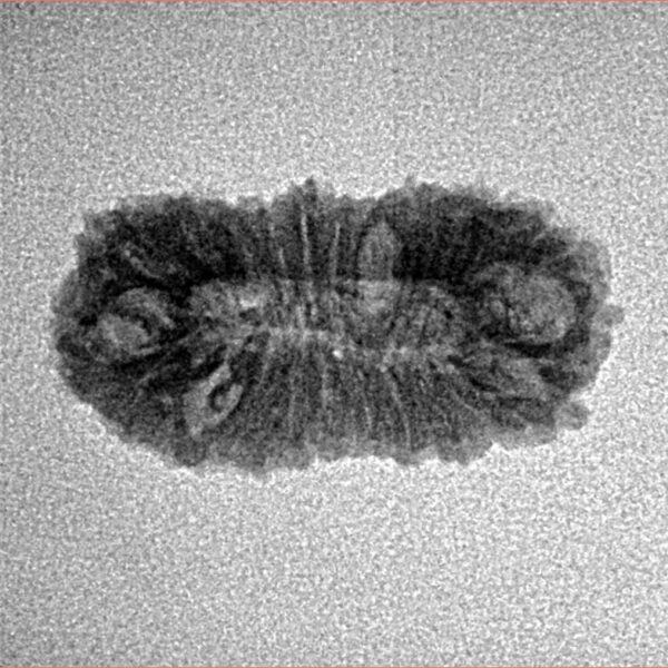 22 Mukhi Rudraksha 21.9mm 1.42gm - Inverse xray