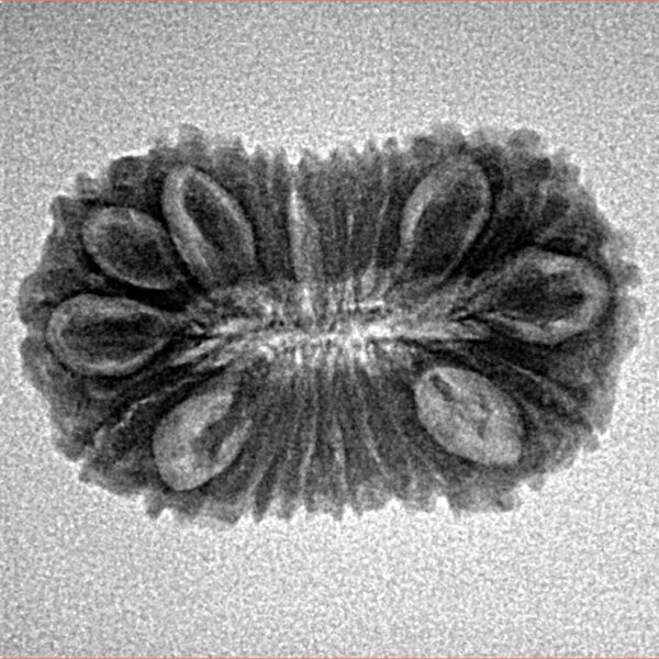 20 Mukhi Rudraksha 24.1mm 2.32gm - Inverse xray