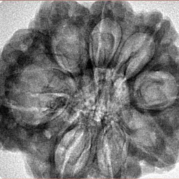 8 Mukhi Rudraksha 31.1mm 7.43gm - Inverse xray
