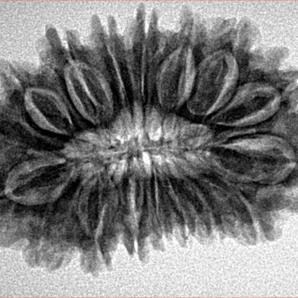 17 Mukhi Rudraksha 30.2mm 4.91gm - Inverse xray