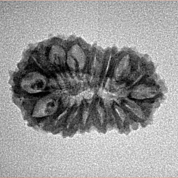 16 Mukhi Rudraksha 22.6mm 1.71gm - Inverse xray