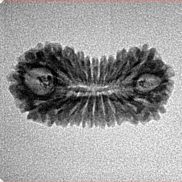21 Mukhi Rudraksha 23.3mm 1.33gm - Inverse xray