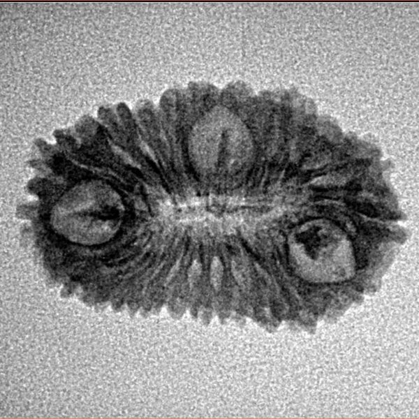 23 Mukhi Rudraksha 23.9mm 1.7gm - Inverse xray