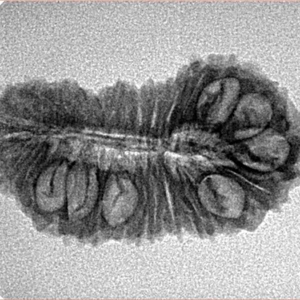 30 Mukhi Rudraksha 28mm 2.54gm - Inverse xray
