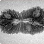 26 Mukhi Rudraksha 31.3mm 3.43gm - Inverse xray