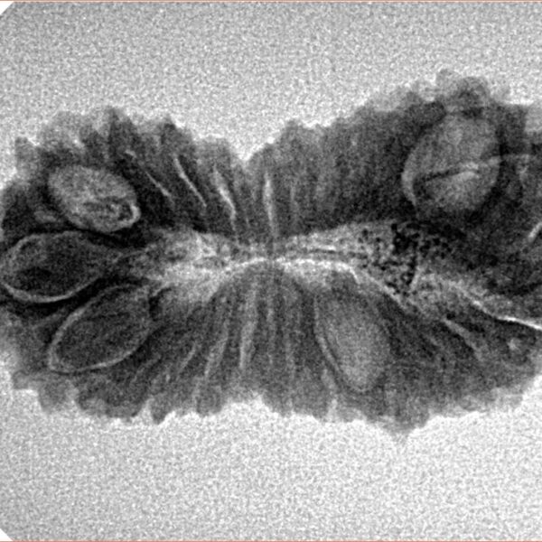 26 Mukhi Rudraksha 31.3mm 3.43gm - Inverse xray