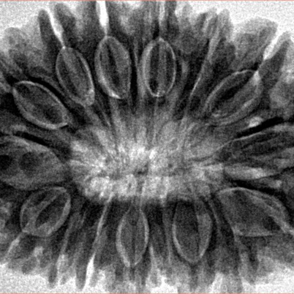 16 Mukhi Rudraksha 35.7mm 9.17gm - Inverse xray