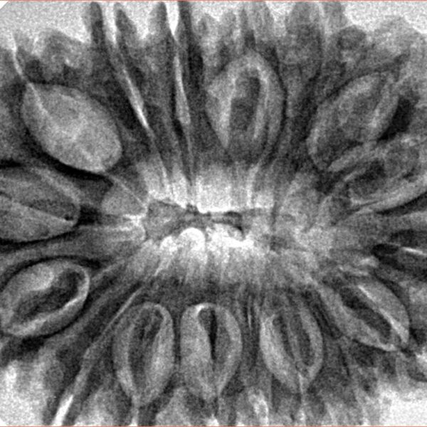 17 Mukhi Rudraksha 35.7mm 7.48gm - Inverse xray
