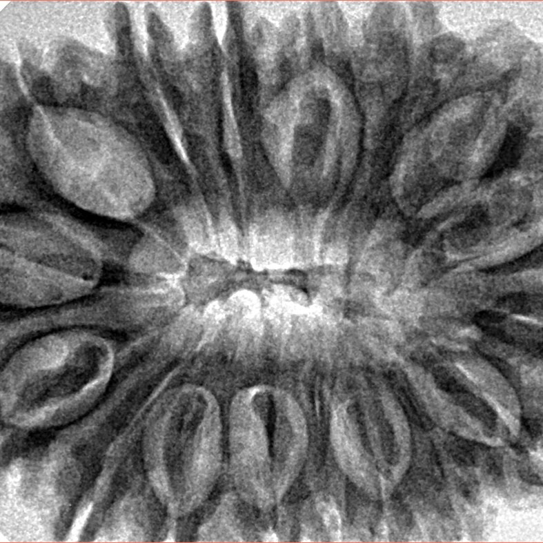 17 Mukhi Rudraksha 35.7mm 7.48gm - Inverse xray