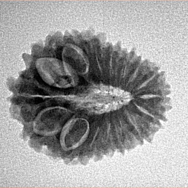16 Mukhi Rudraksha 22.5mm 2.62gm - Inverse xray