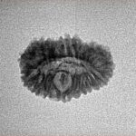 22 Mukhi Rudraksha 18.1mm 1.14gm - Inverse xray