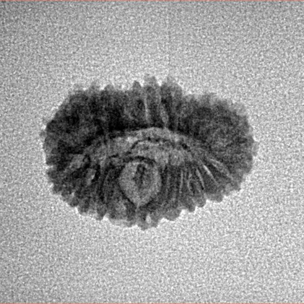 22 Mukhi Rudraksha 18.1mm 1.14gm - Inverse xray