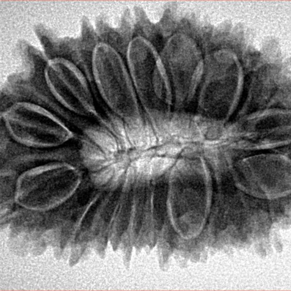 17 Mukhi Rudraksha 32.4mm 5.94gm - Inverse xray