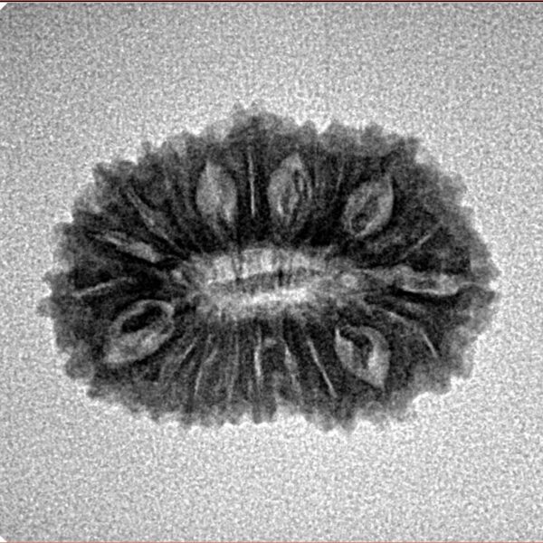 20 Mukhi Rudraksha 21.8mm 2gm - Inverse xray