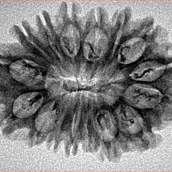 16 Mukhi Rudraksha 29.7mm 2.83gm - Origin: Nepal - Inverse xray