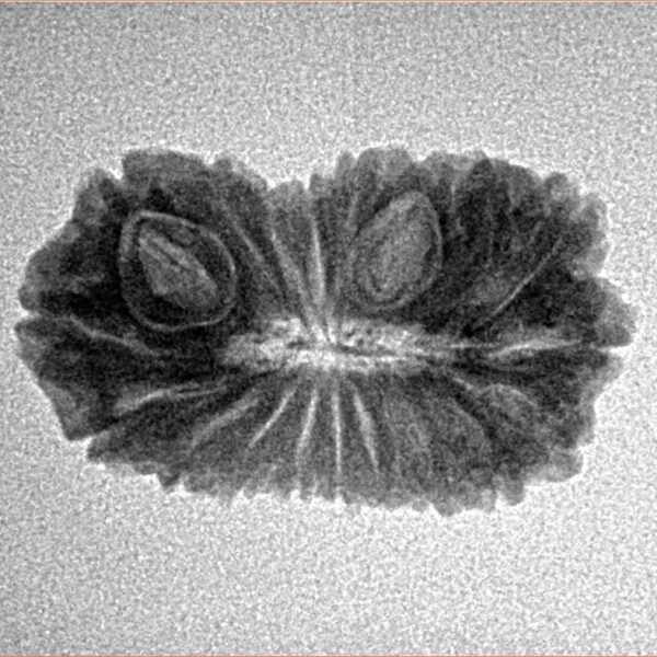 19 Mukhi Rudraksha 23.9mm 2.25gm - Inverse xray