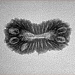 24 Mukhi Rudraksha 23.5mm 1.8gm - Inverse xray
