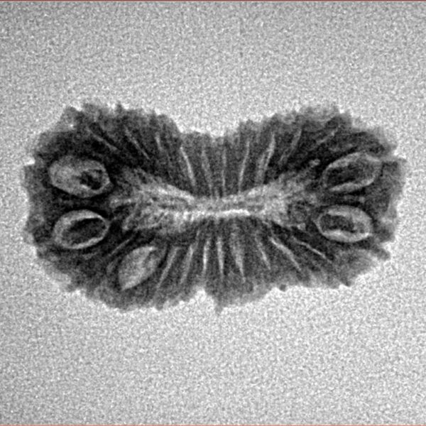 24 Mukhi Rudraksha 23.5mm 1.8gm - Inverse xray