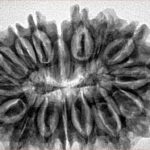 16 Mukhi Rudraksha 33.8mm 5.85gm - Inverse xray