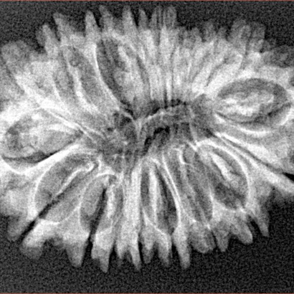 18 Mukhi Rudraksha 31.3mm 4.35gm - Origin: Nepal - Xray