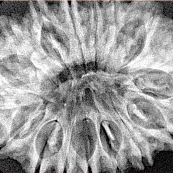 17 Mukhi Rudraksha 34mm 6.55gm - Xray